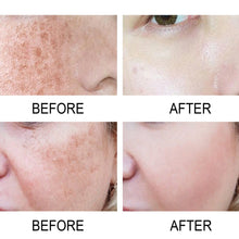 Load image into Gallery viewer, Nicotinamide Serum Facial Dark Spot Correcting Solution Fade Black Spots Moisturizing Skin Care Oil